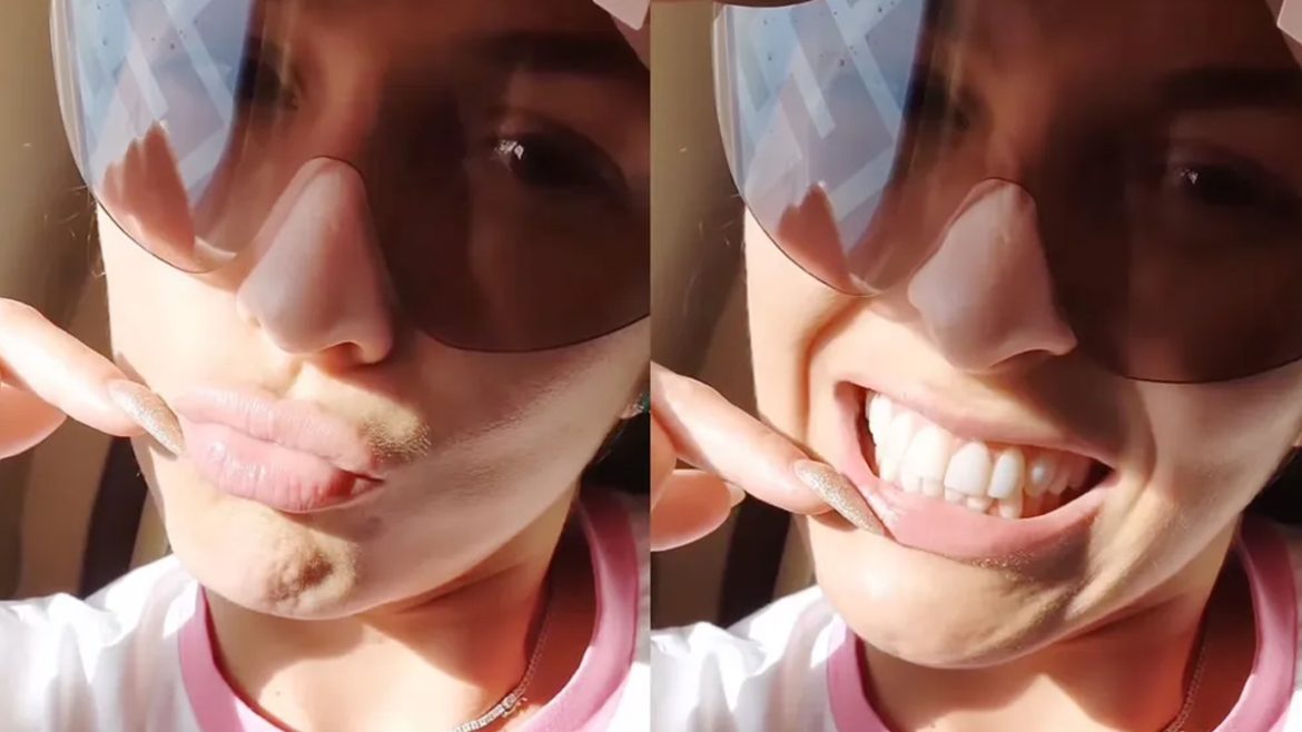 livia-andrade-se-diverte-ao-mostrar-dente-quebrado:-sorria